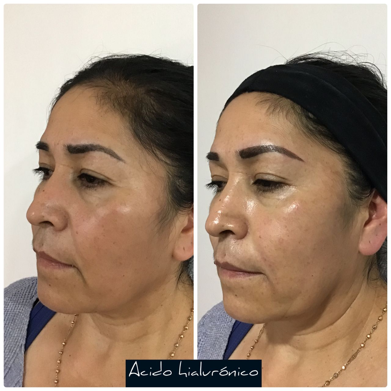 Yolanda Herrera Pablo-1