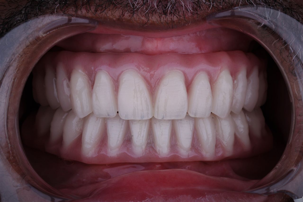 Arturo Mendez Valencia-5