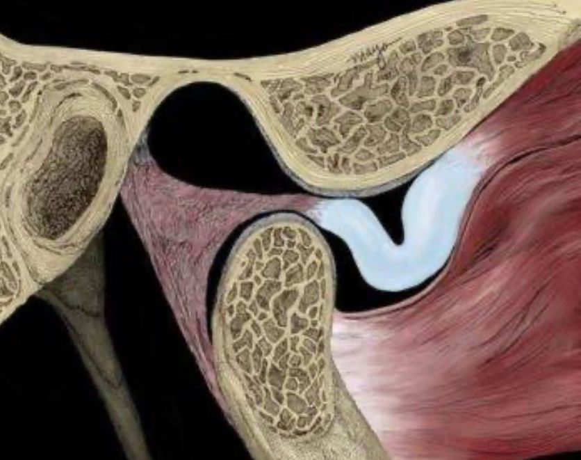 Erendalhi Rocha Mesta-9