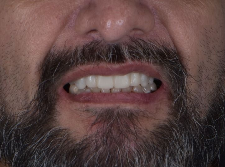 Sebastian Chaustre-7