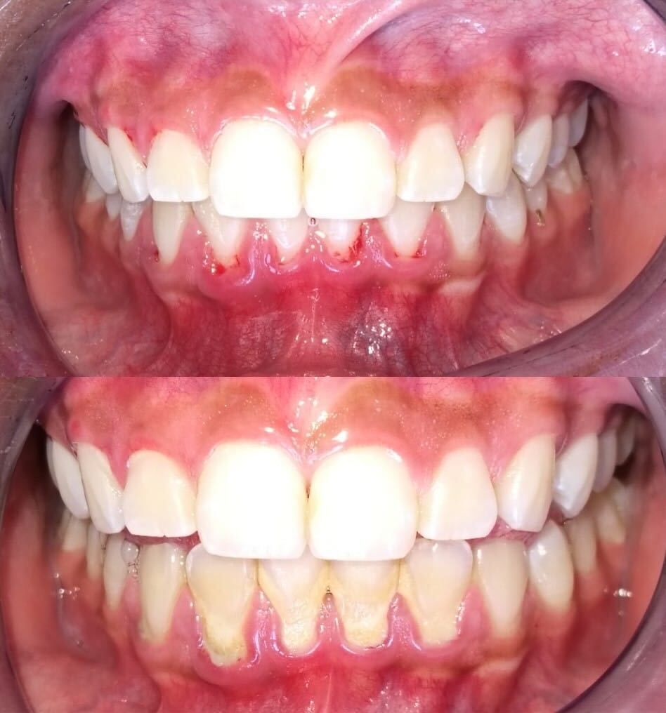 Luz Anel Valente Lozano-8