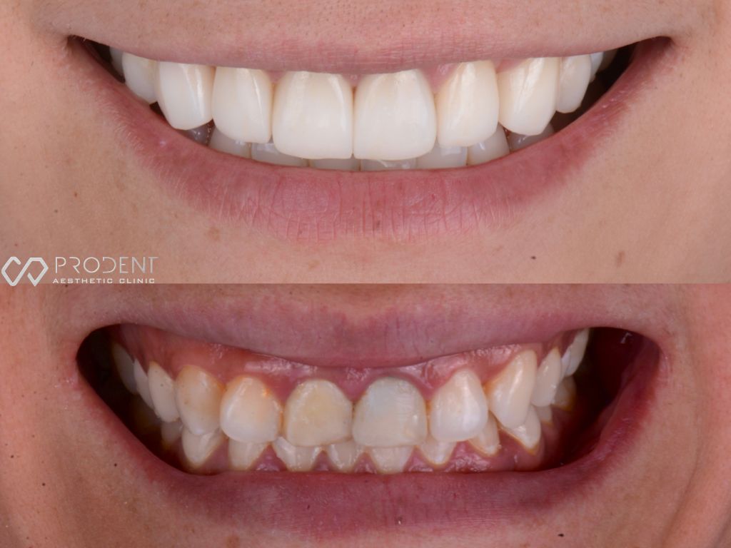 Ulises Pérez Murillo-99