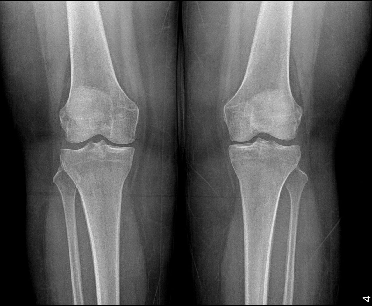 Samuel Garza Pacheco -0