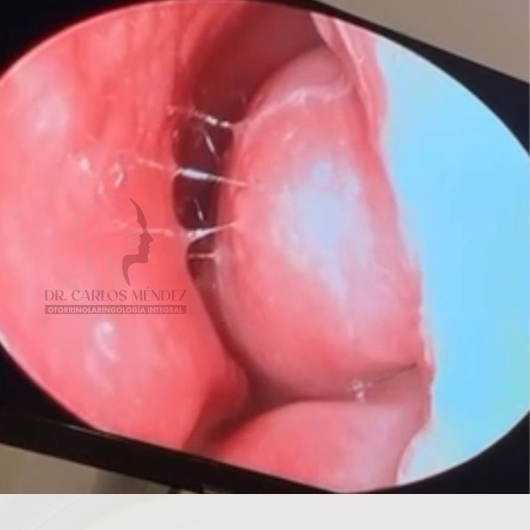 Juan Carlos Mendez Gutierrez-25