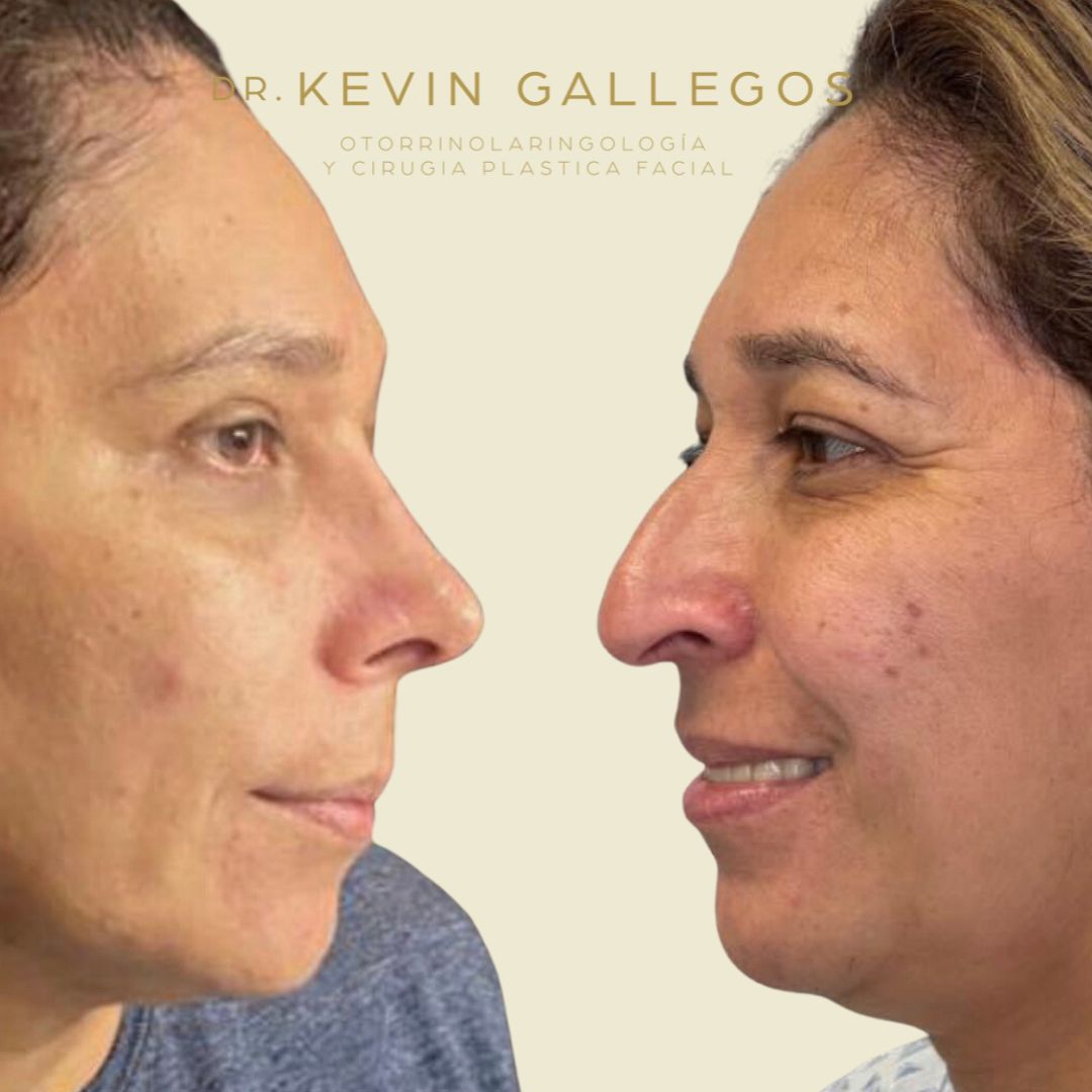 Kevin Iram Gallegos Montero-2