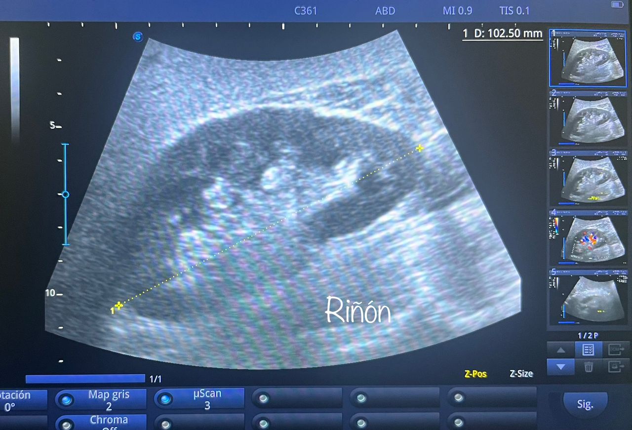 César Guerra Martínez-36