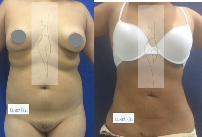 Rubén Nieto Balcázar-3