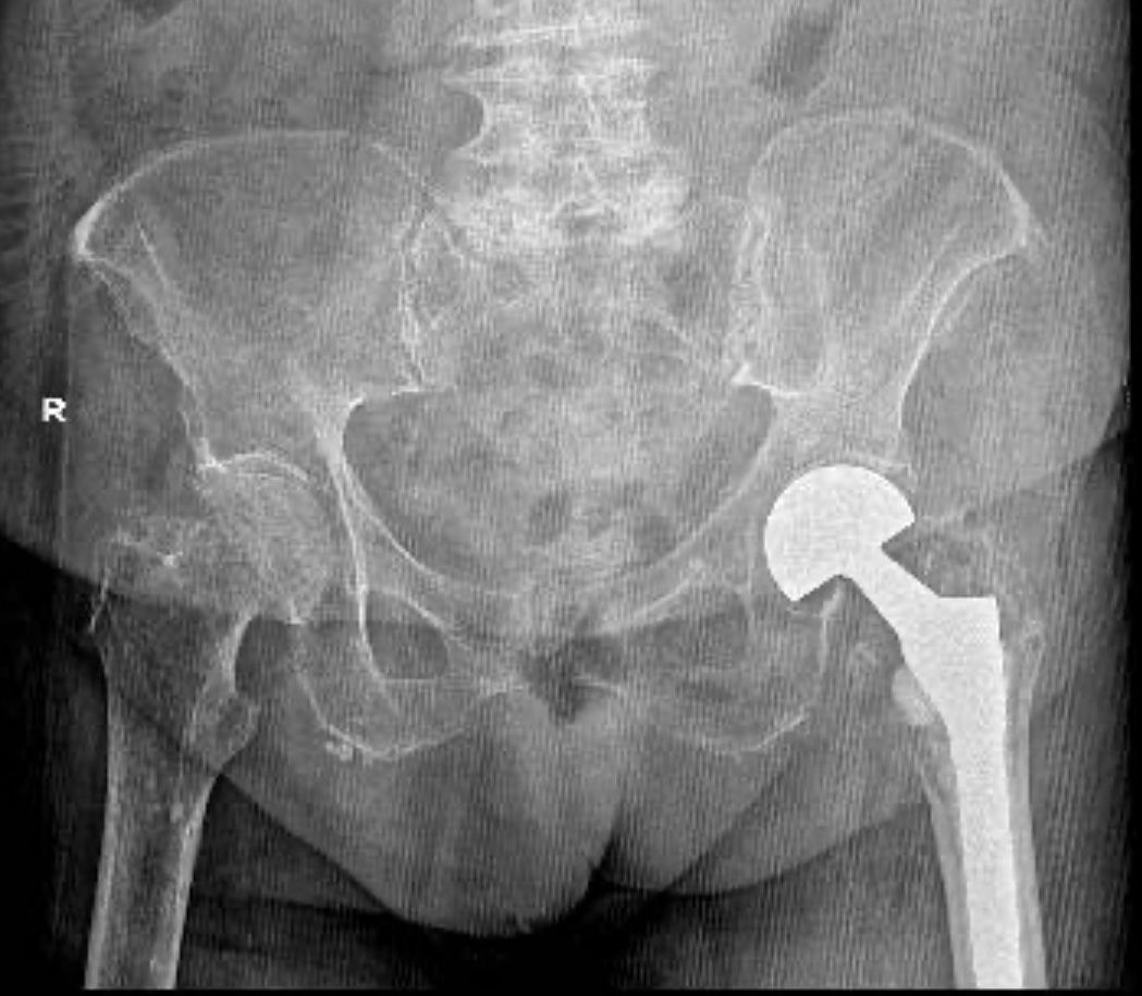 Fidel Velázquez Muñoz-1