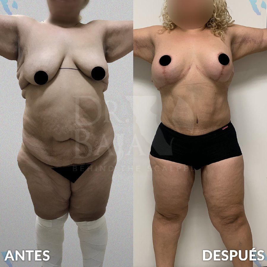 Renato Rodríguez Hirales-41