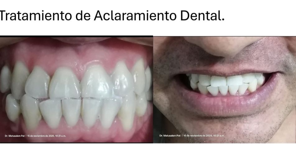 Matusalem Pat Avilés-5