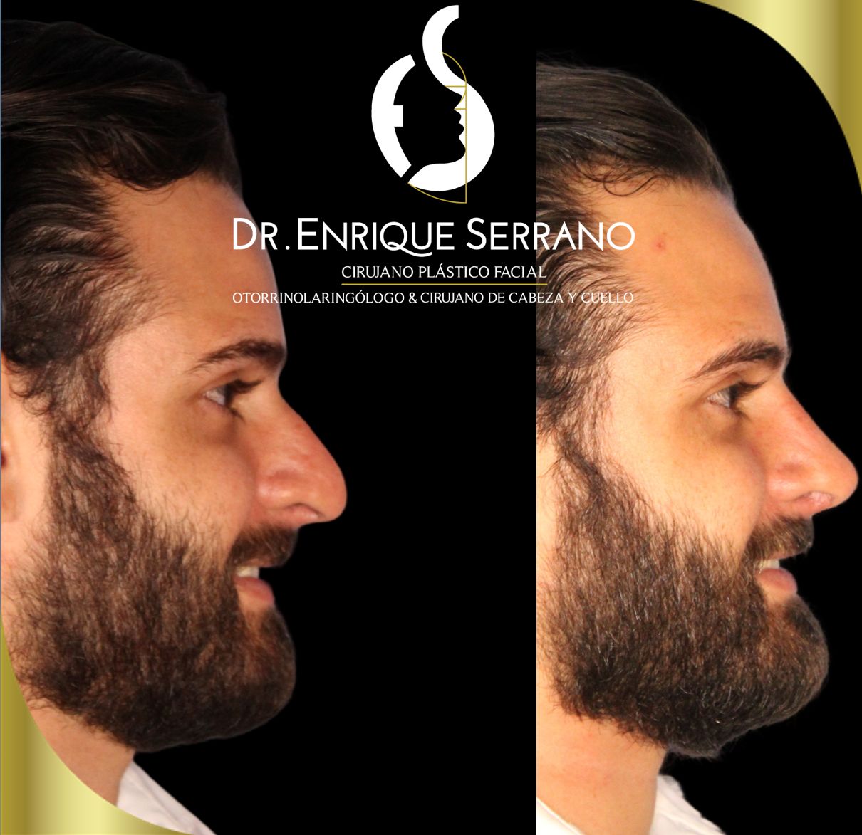 Enrique Serrano Cruz-0