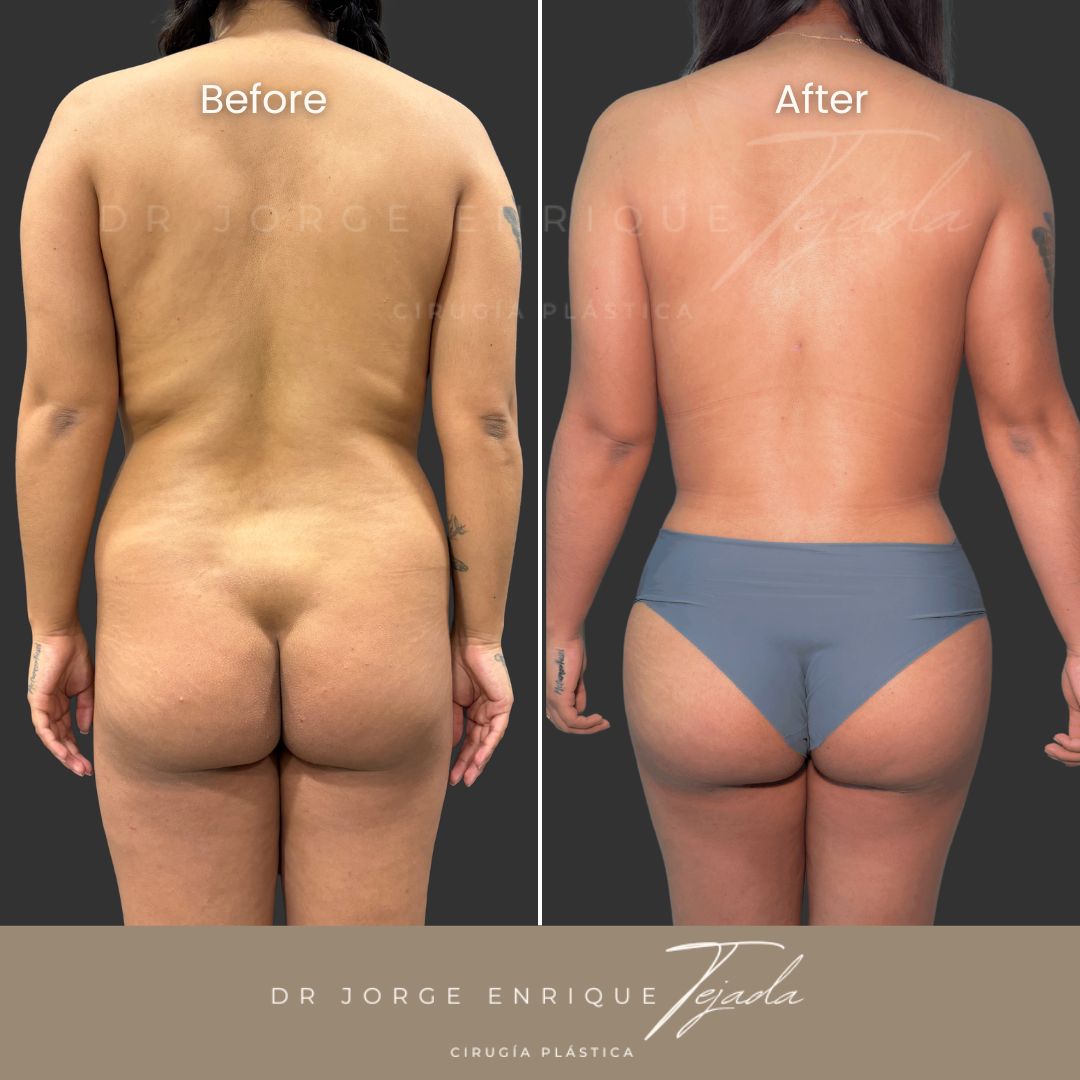 Jorge Enrique Tejada Aldazosa-6