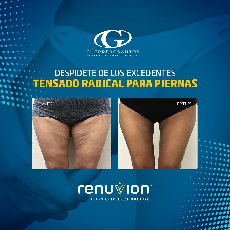 Fernando Guerrerosantos-23