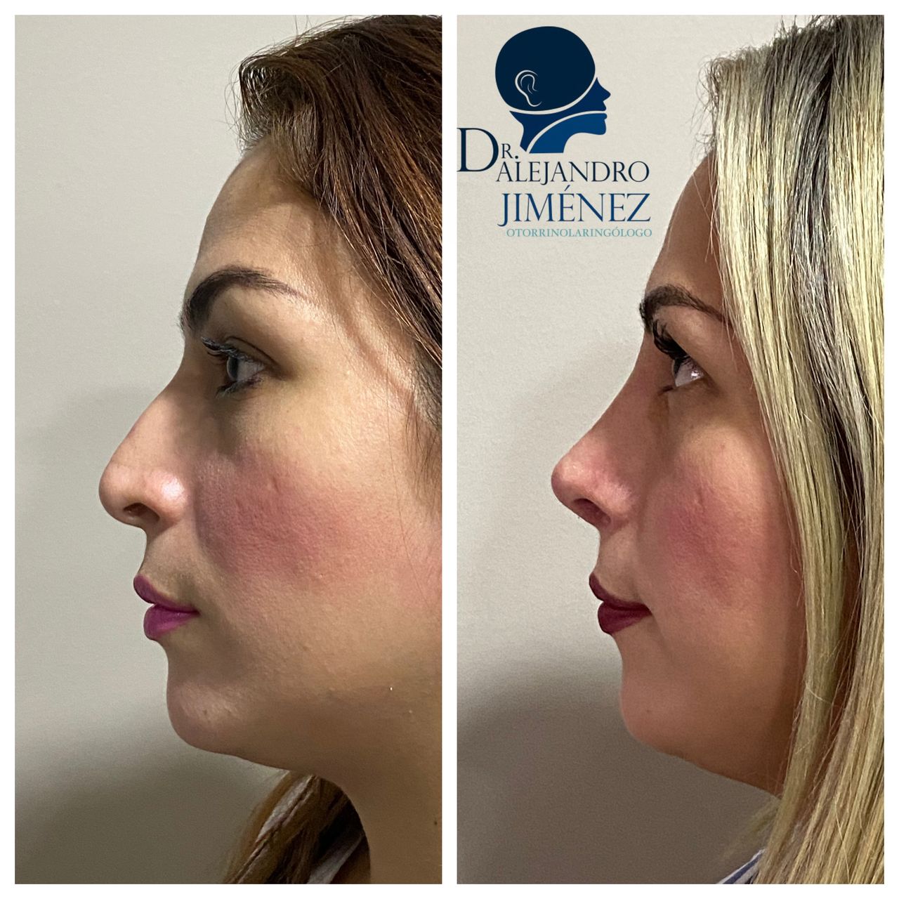 Alejandro Jimenez Garcia-18