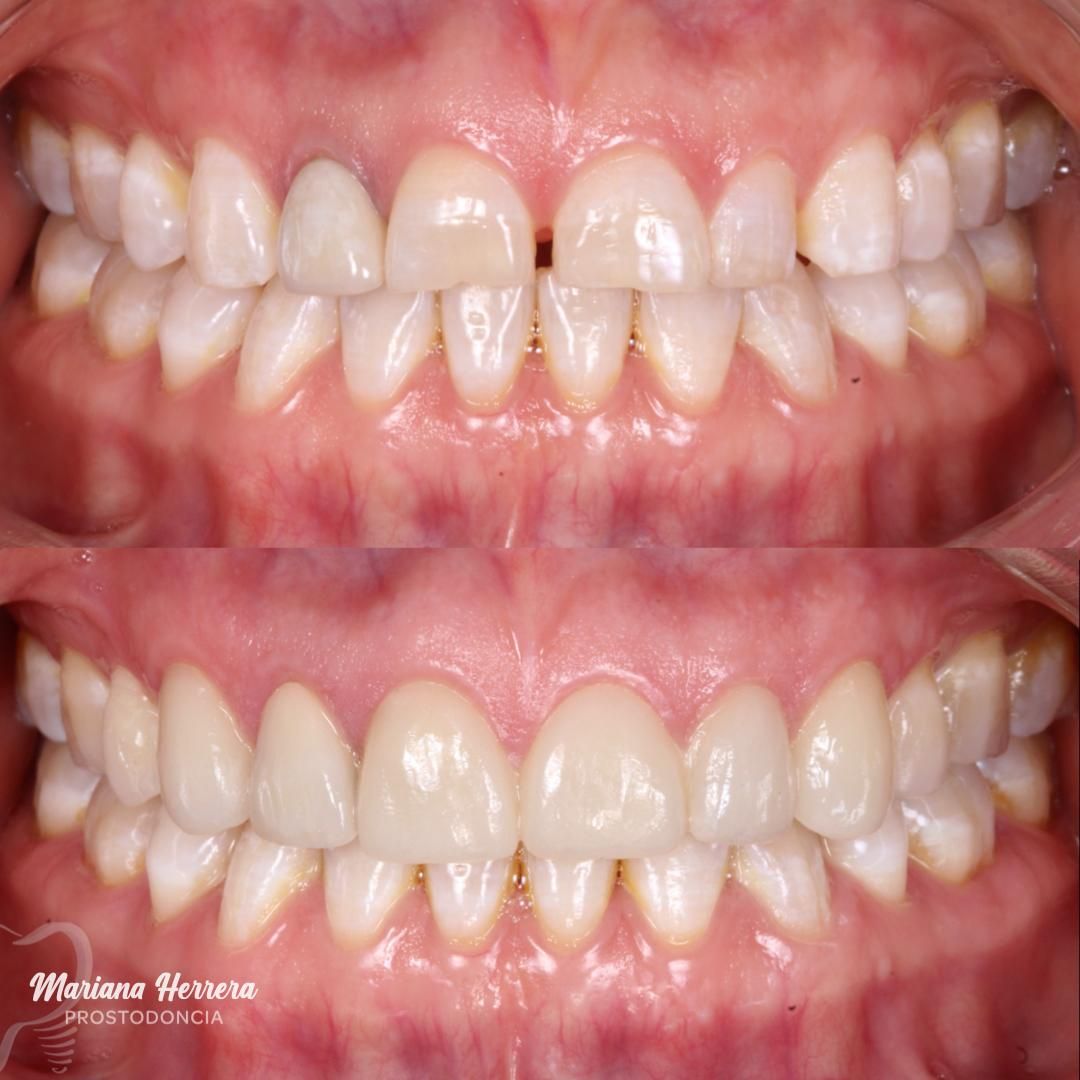 Mariana Herrera Martín Del Campo-8