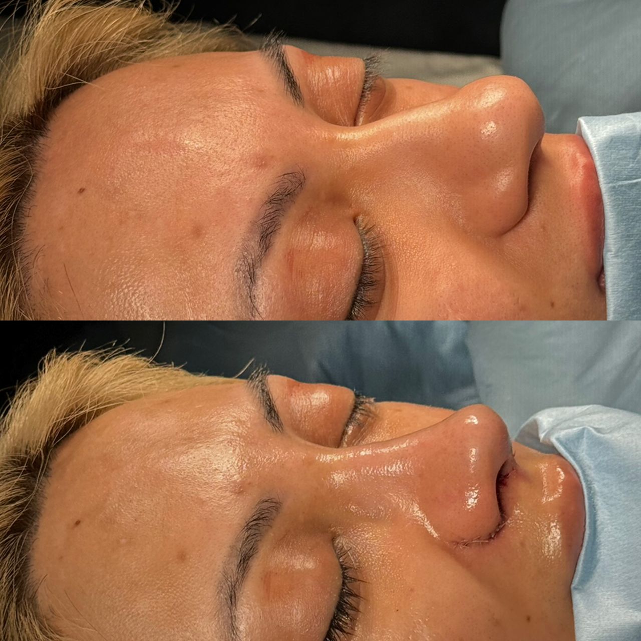 Angel Castro Urquizo-89