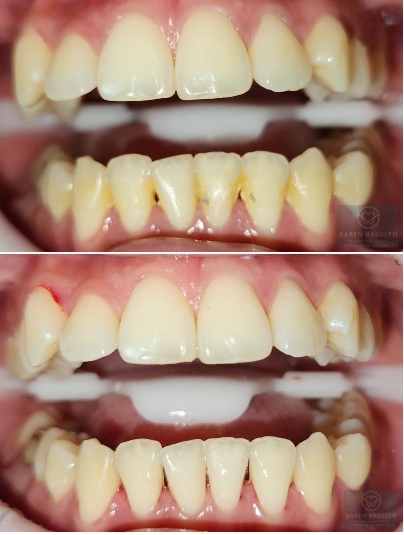 Ana Karen Basulto Cruz-2