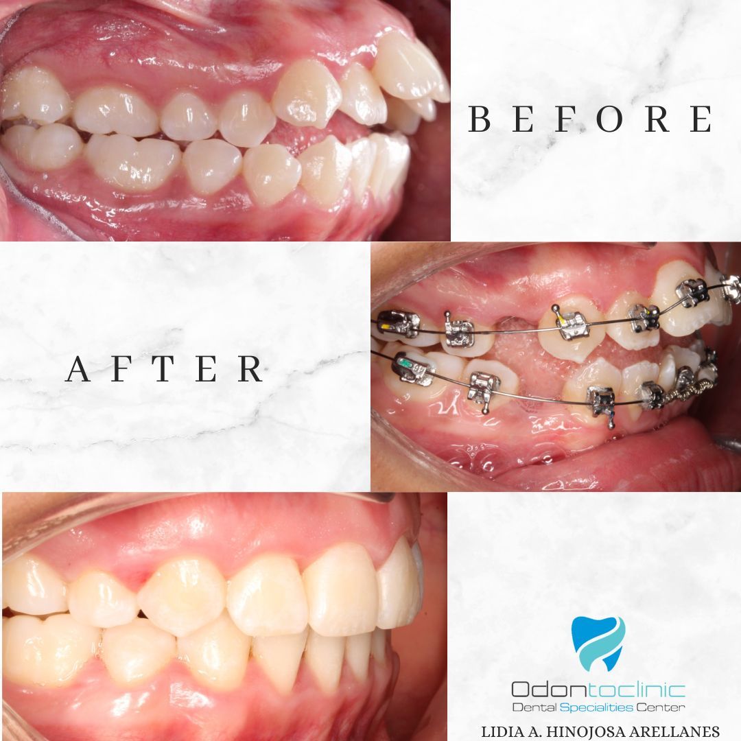 Lidia Abigail Hinojosa Arellanes-11