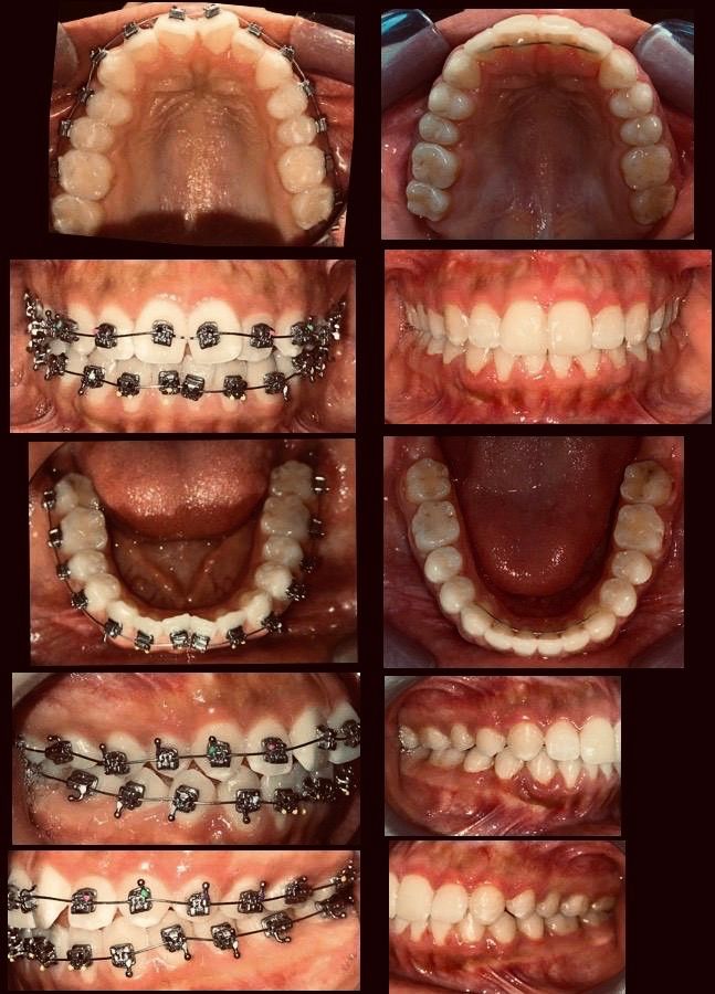 Zuriel Ayala Garcia-8
