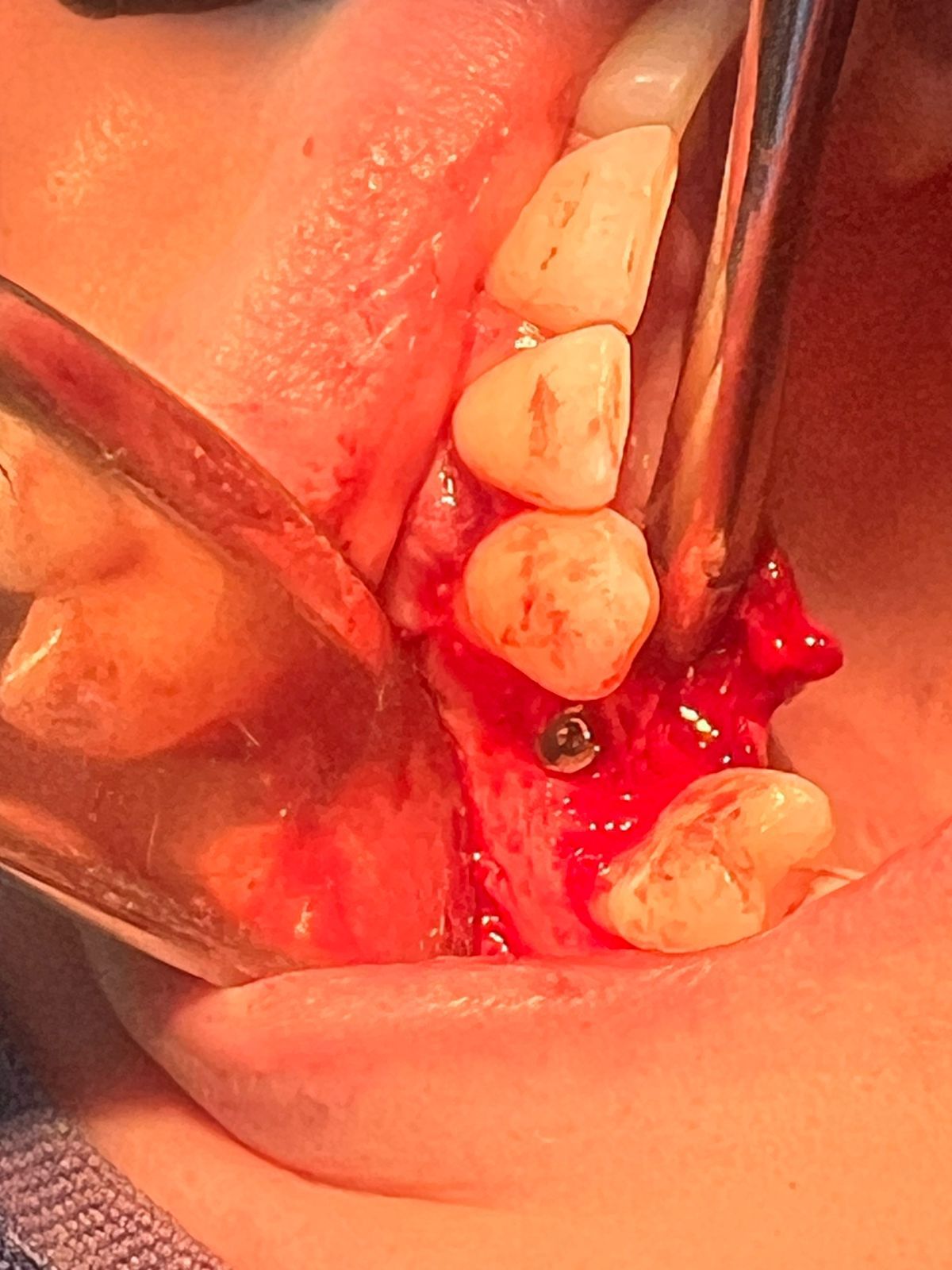 Jair Contreras García-40