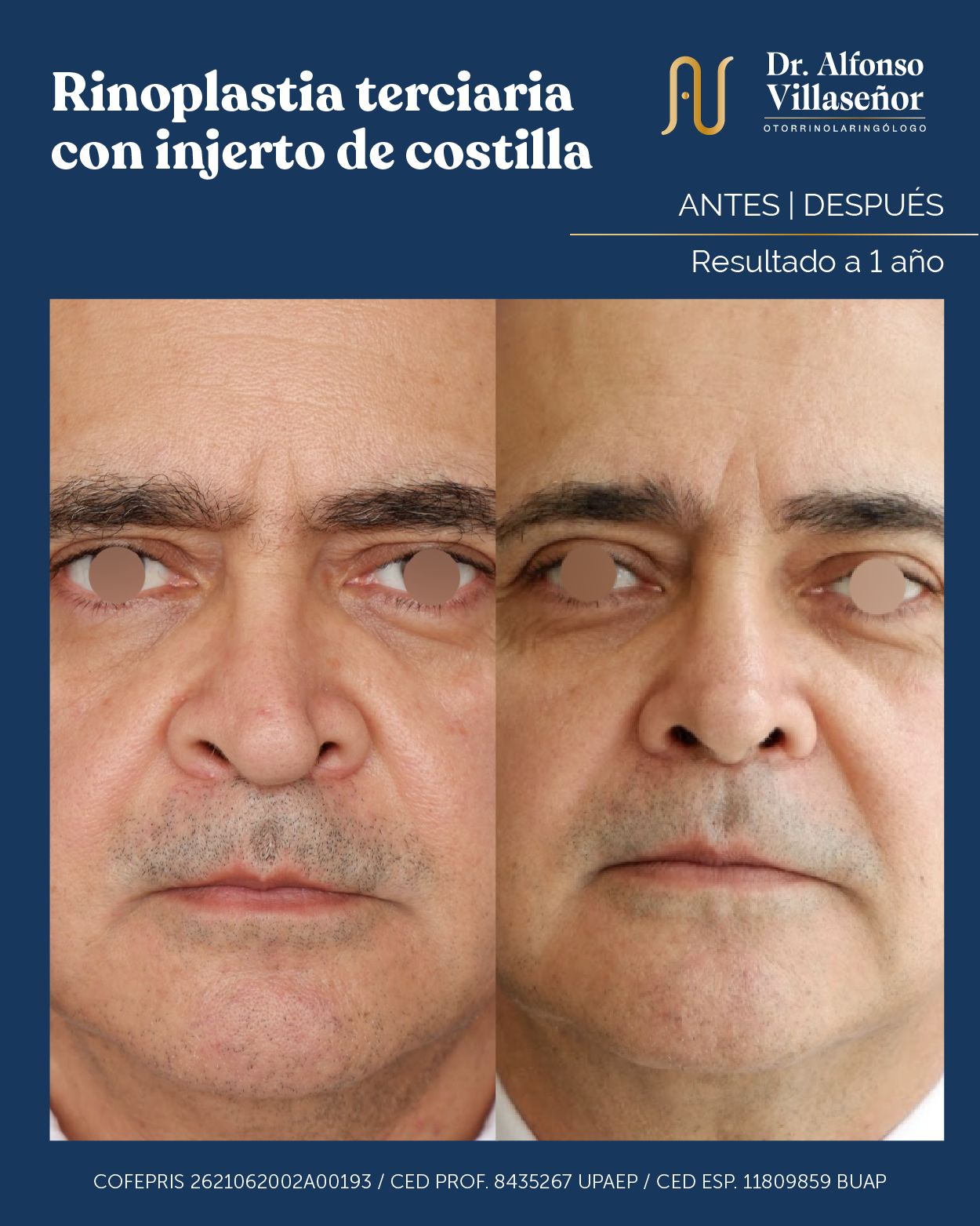 Alfonso Villaseñor Herrero-8