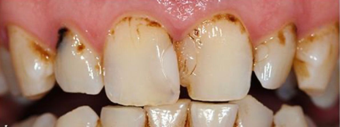 Esmeralda Candida Guerrero Pimentel-11