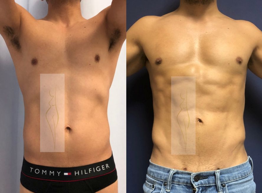 Rubén Nieto Balcázar-11