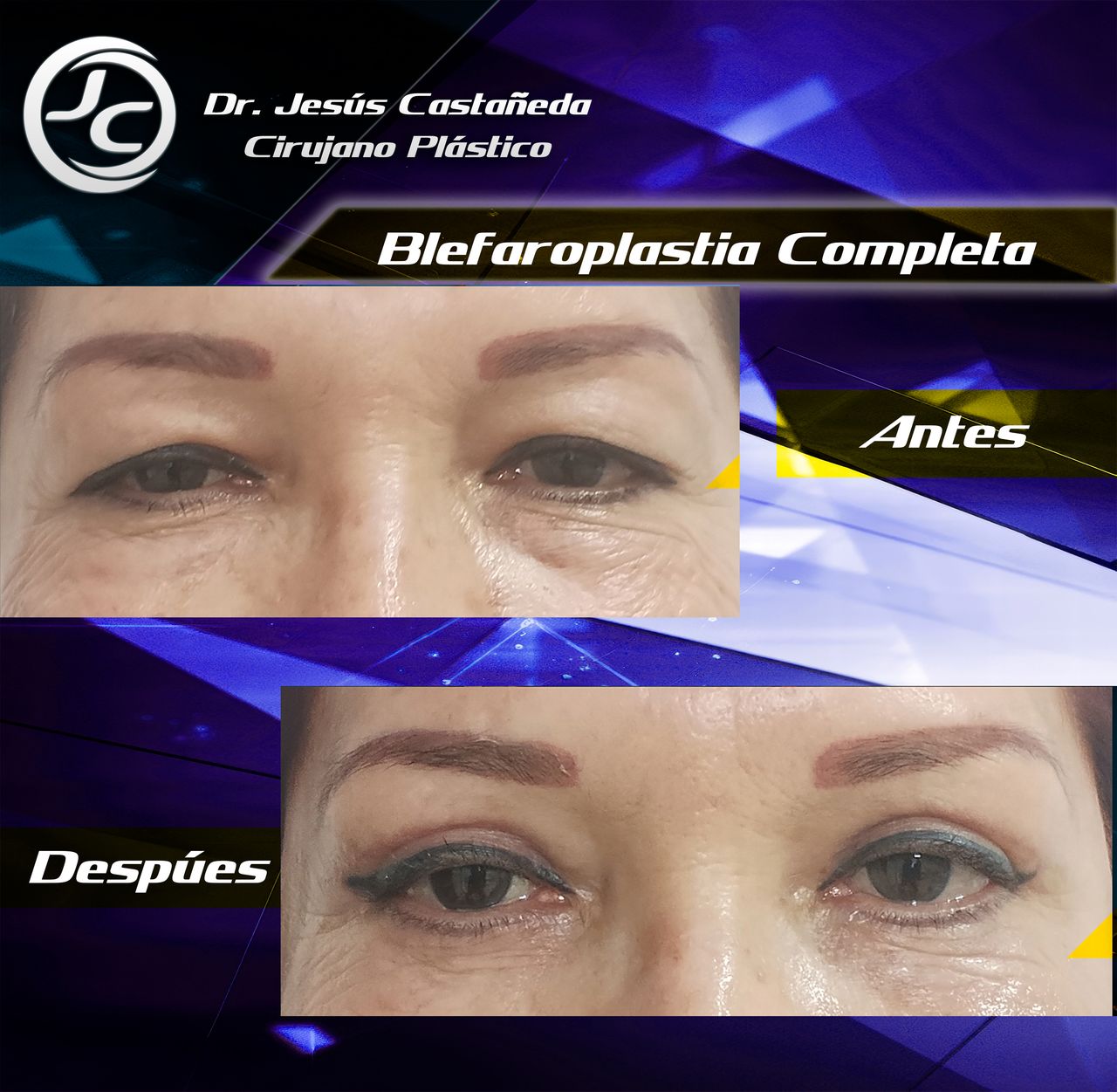 Jesús Castañeda Hernández-3