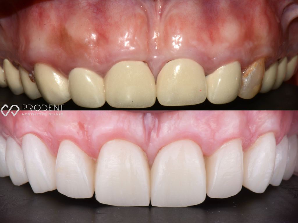 Ulises Pérez Murillo-52