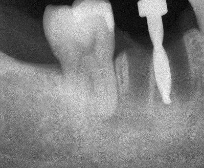 Ivan Torres Rascon-10