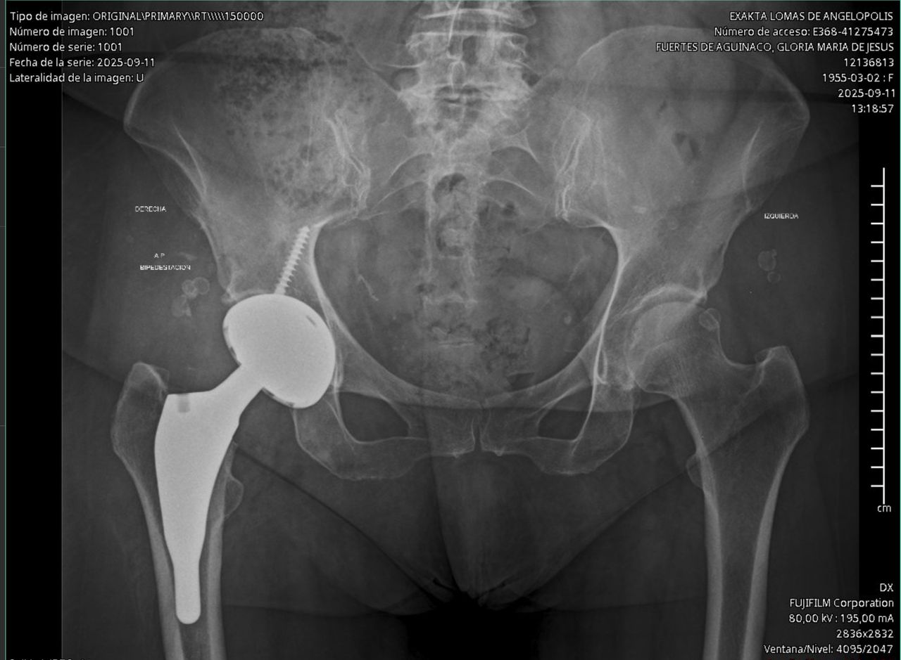 Alejandro Martínez Ramírez-47