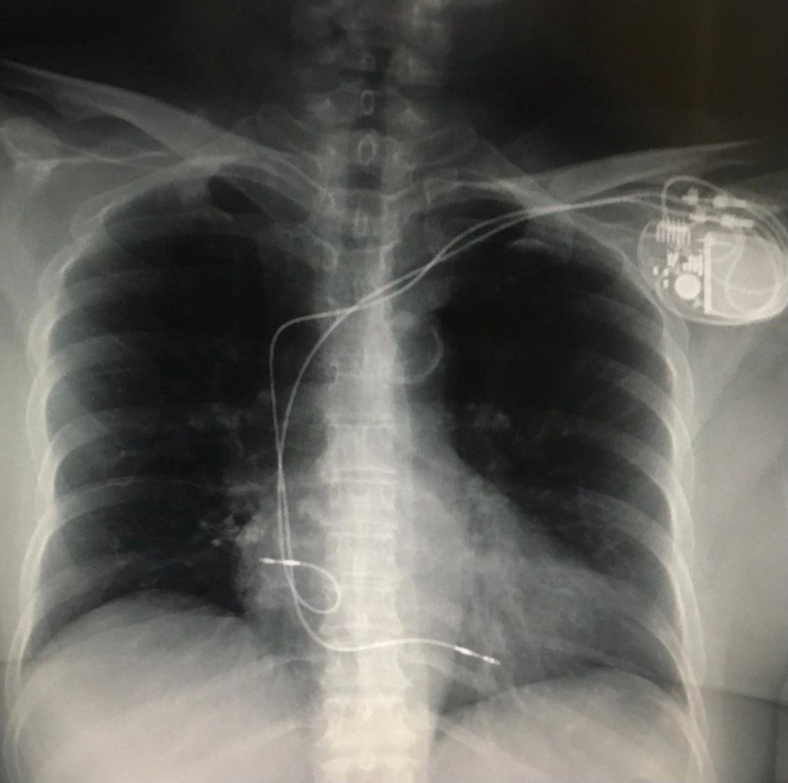 Arturo Moreno Pérez-4