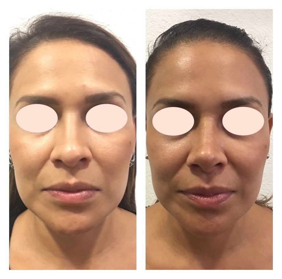 Carola Berenice Curiel Davalos-42