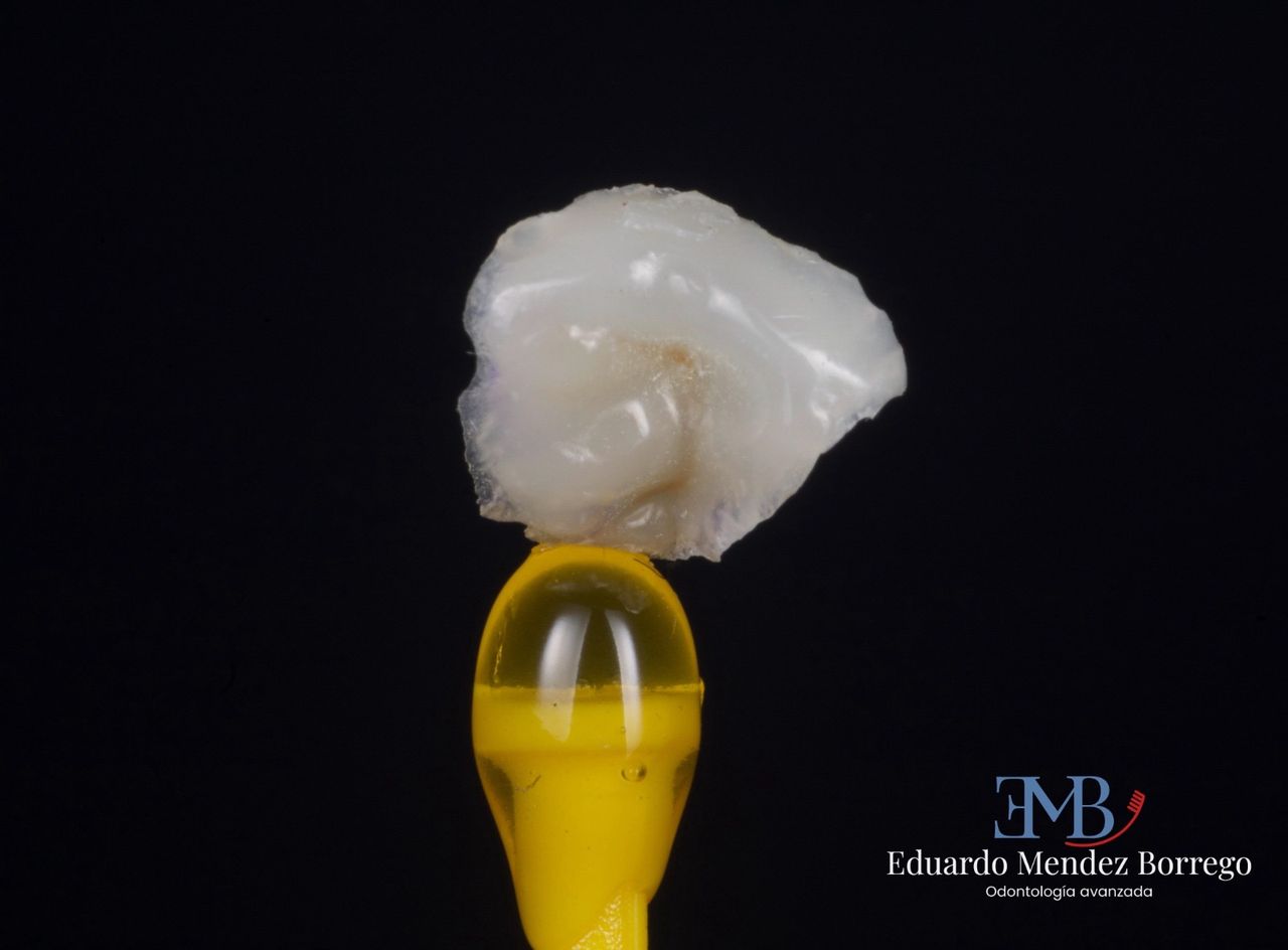 Hervin Eduardo Mendez Borrego-7