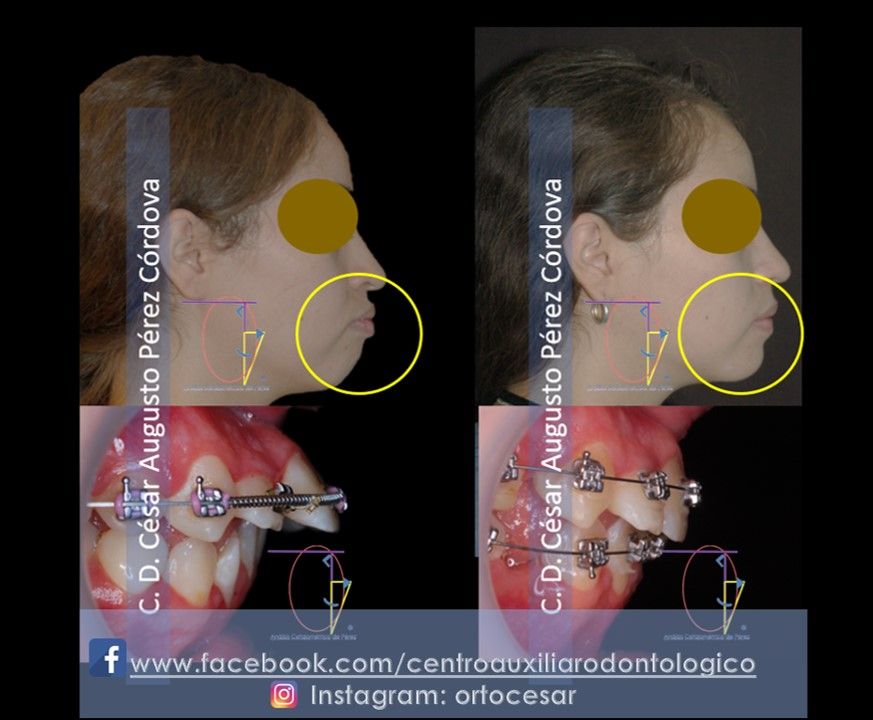 César Augusto Pérez Córdova-39
