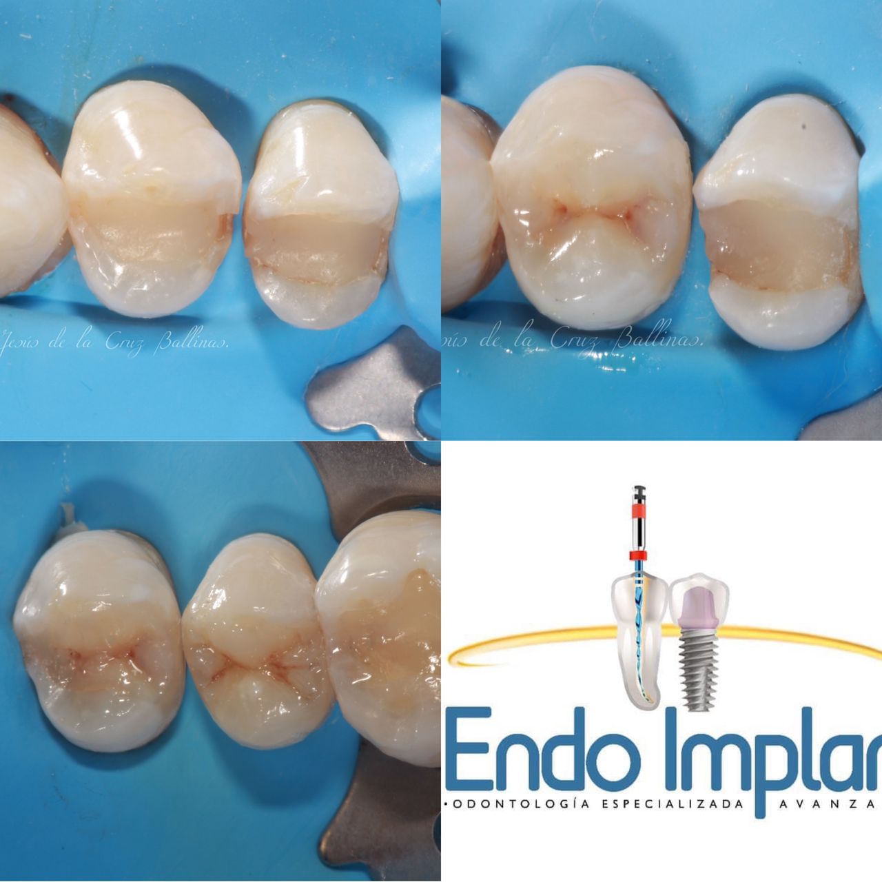 Jesus De La Cruz Ballinas-10