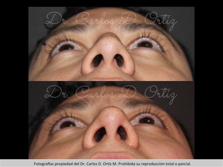 Carlos David Ortiz Moreno-40