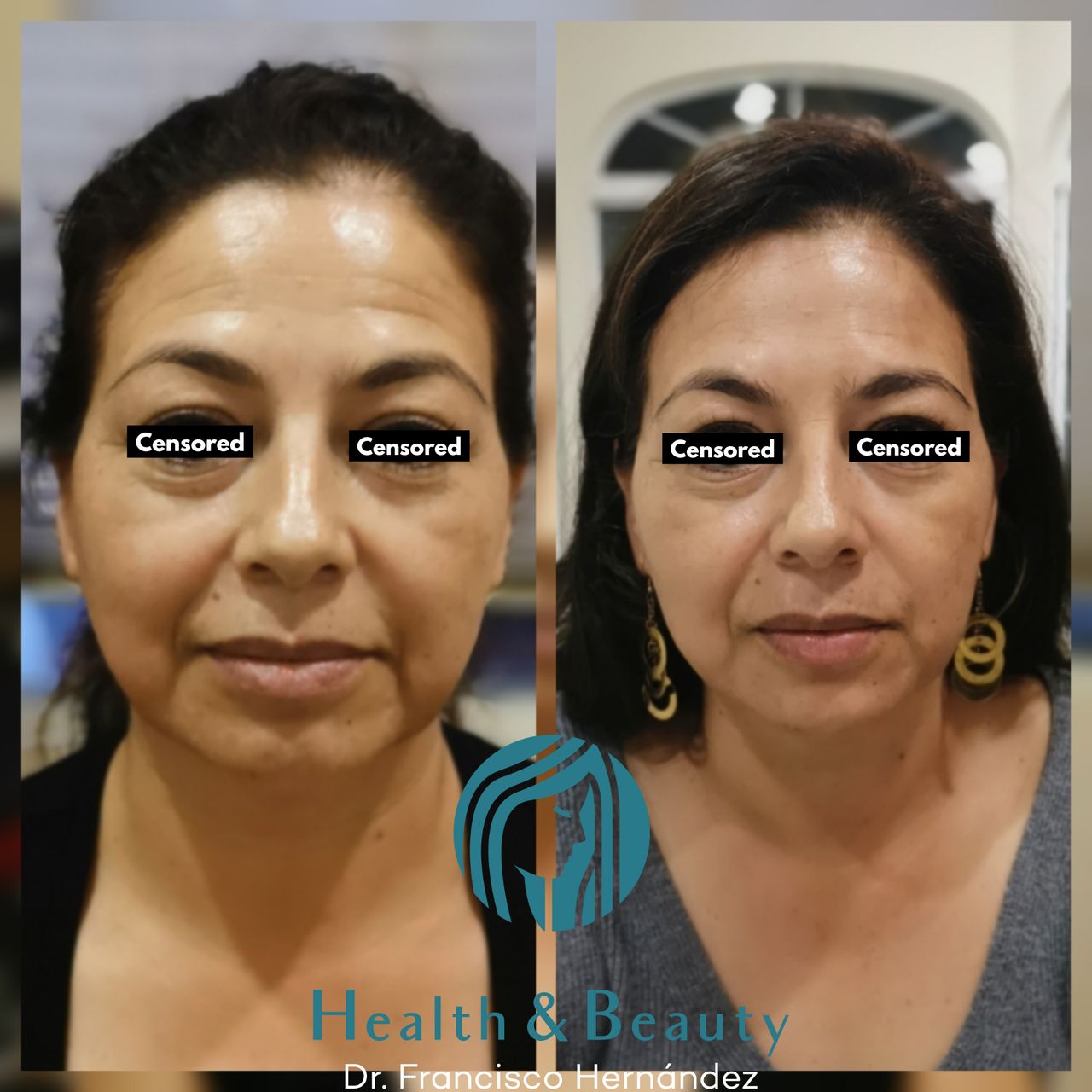 Francisco Hernández Gómez Crespo-179