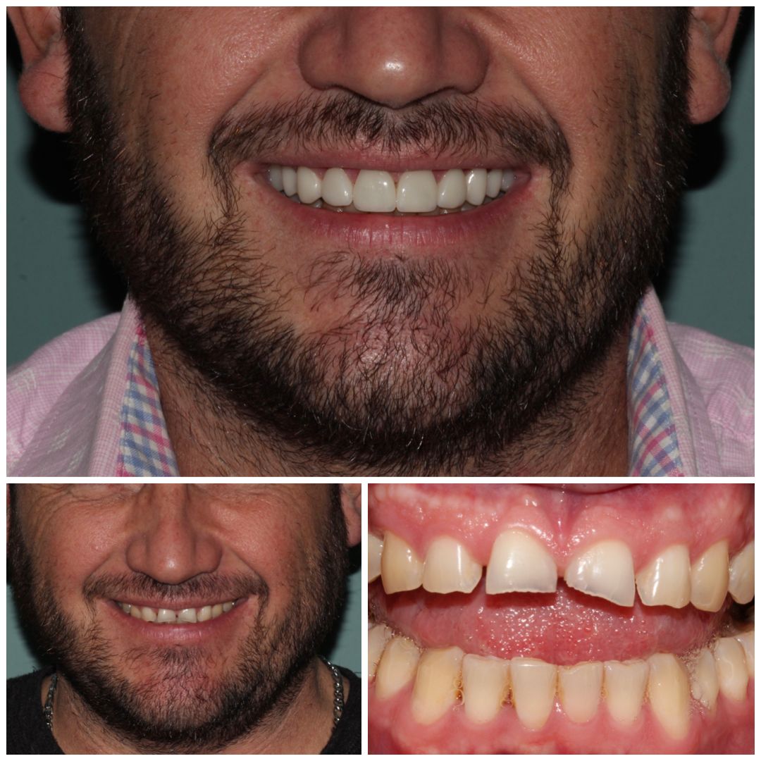 Karla Alvarez Treviño-4