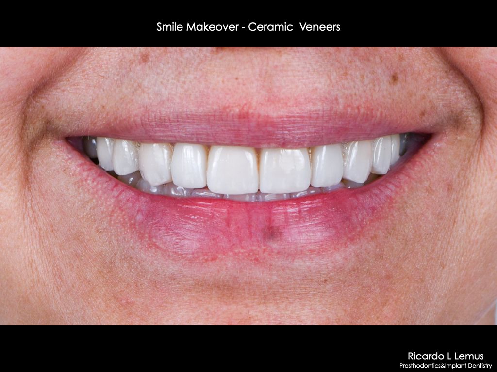 Ricardo López Lemus-5