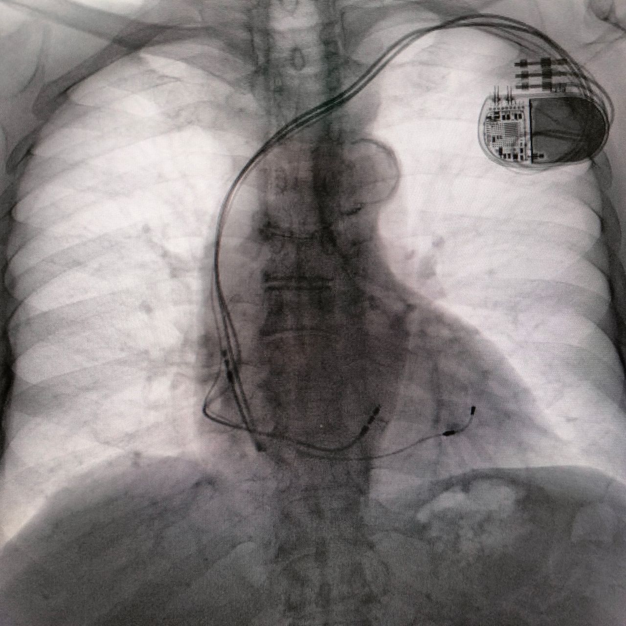 Diego Ross Alvarez-5