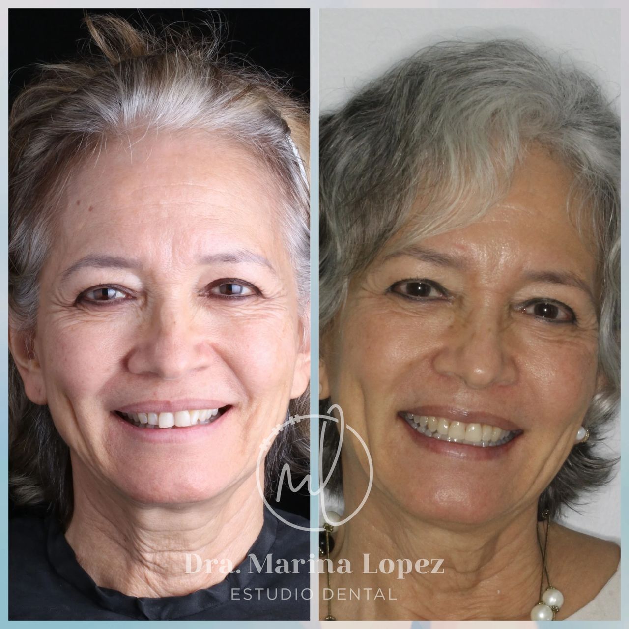 Marina Lopez Del Hoyo-14