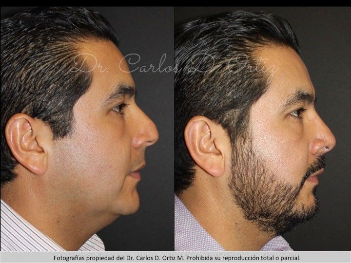 Carlos David Ortiz Moreno-57