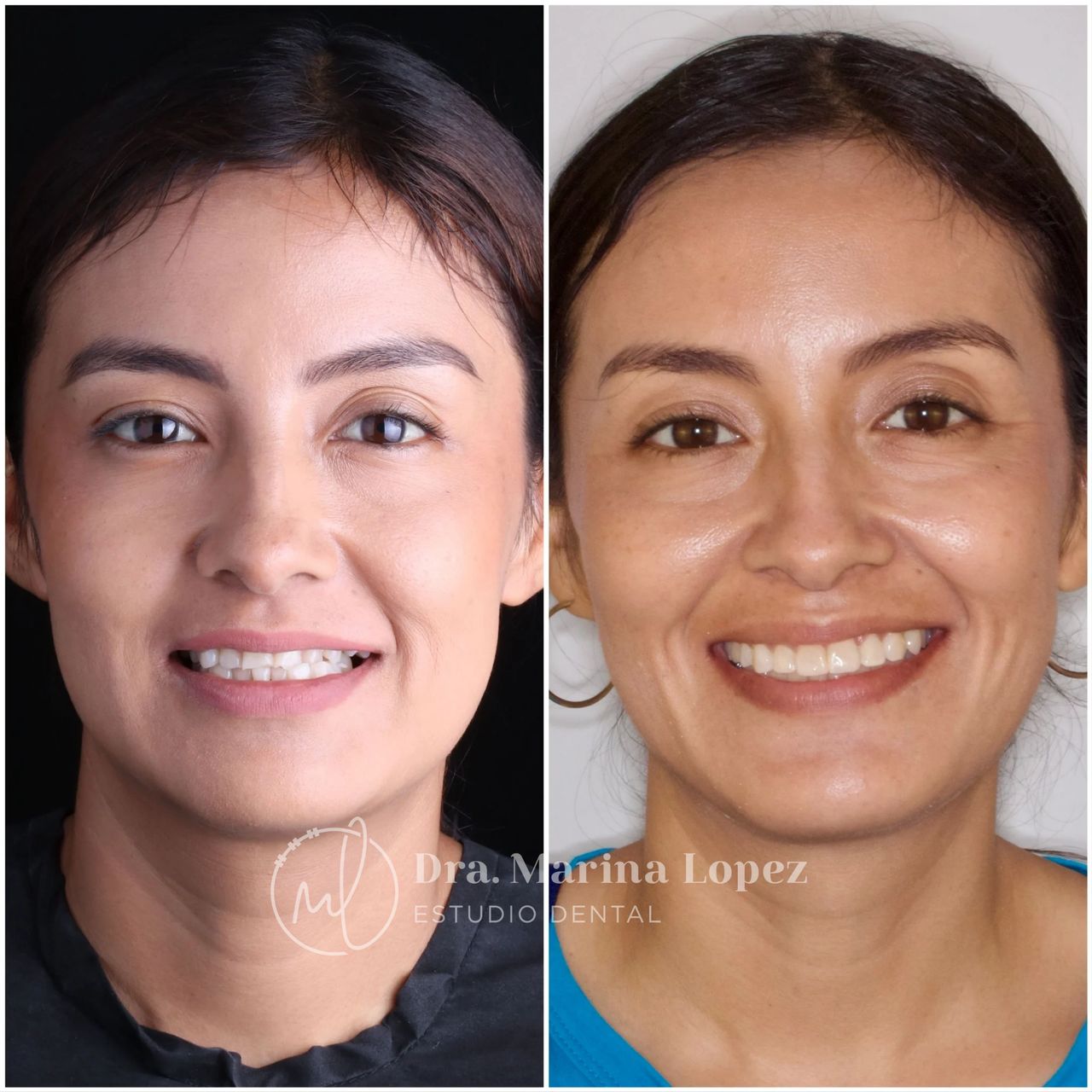 Marina Lopez Del Hoyo-15