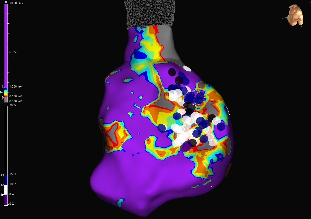 Juan Alberto Vargas Mejia-3