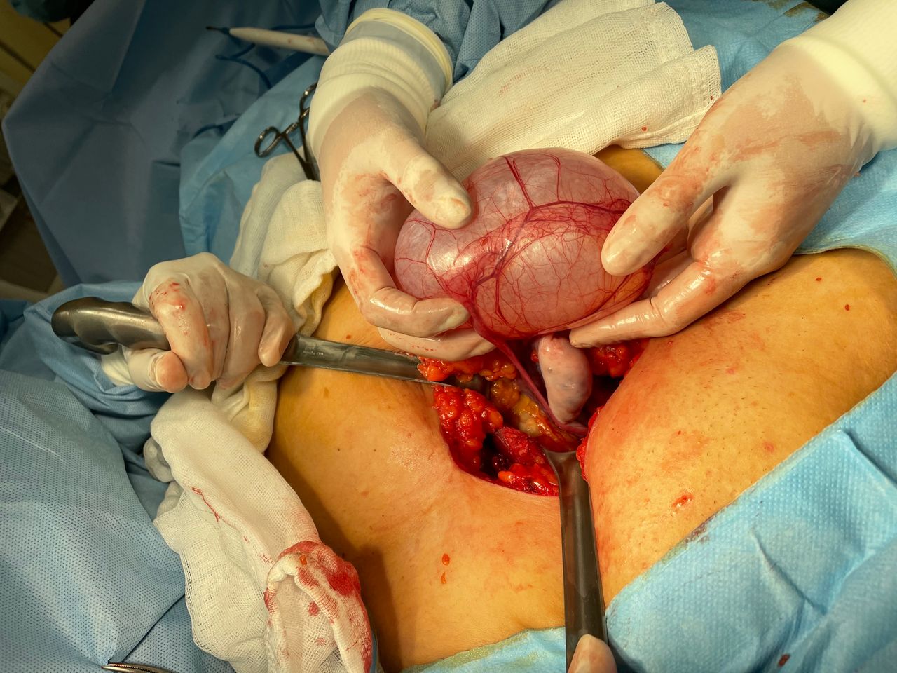 Gonzalo Hernández Martínez-33