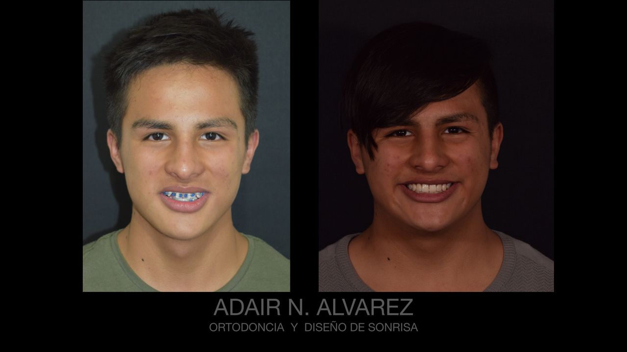 Adair Natanael Alvarez Castañeda-13