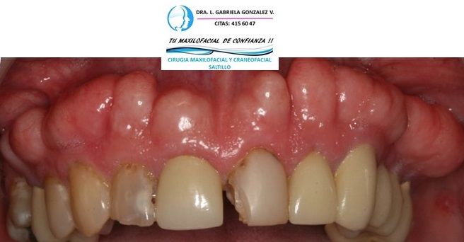 Laura Gabriela González Valdéz-55