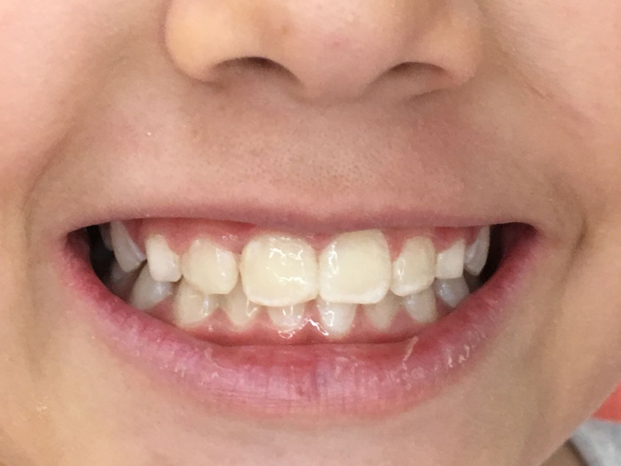 Patricia Rizo Palos-9