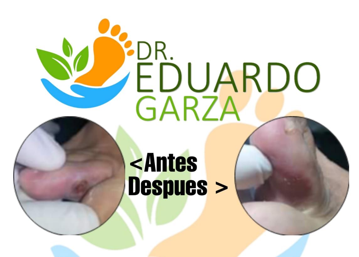 Eduardo Garza Vázquez-16